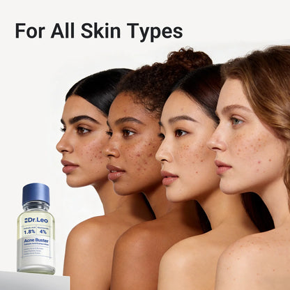1.8% Salicylic Acid Acne Spot Treatment Drying Lotion