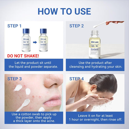 1.8% Salicylic Acid Acne Spot Treatment Drying Lotion