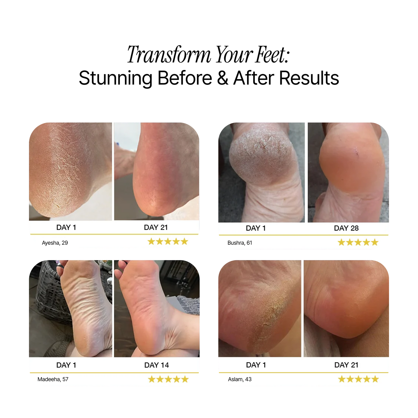 Electric Foot Callus Remover