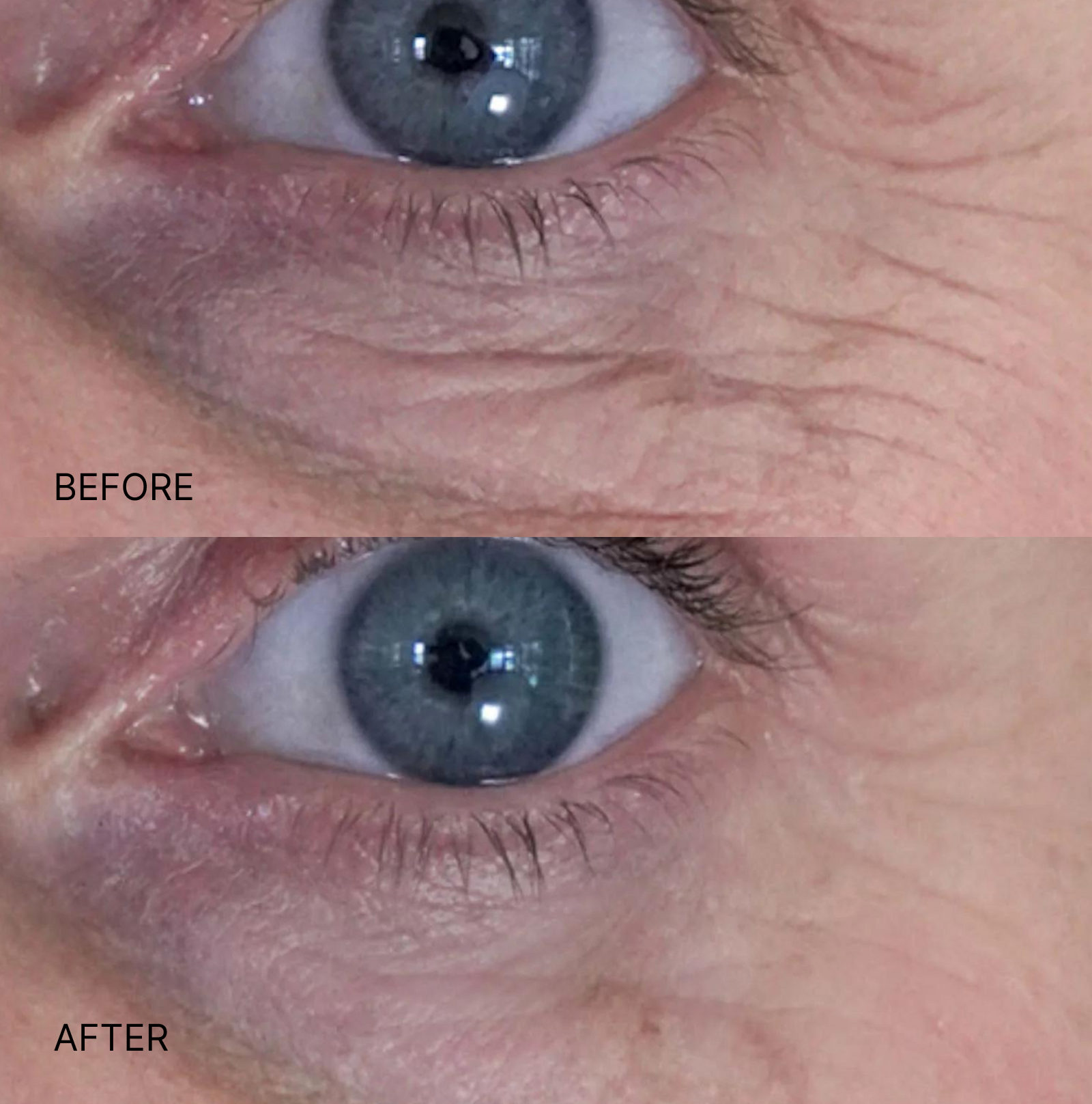 Ultimate Wrinkle Smoothing Set