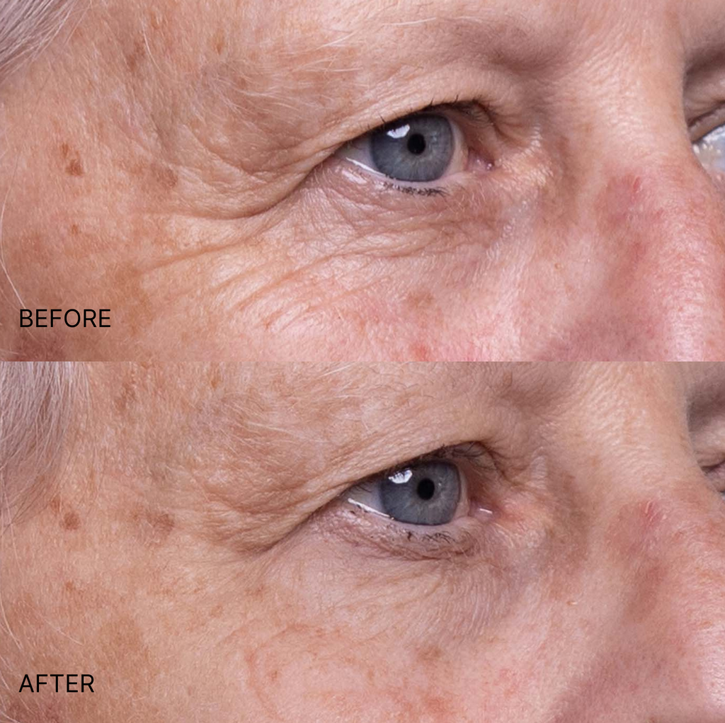 Ultimate Wrinkle Smoothing Set