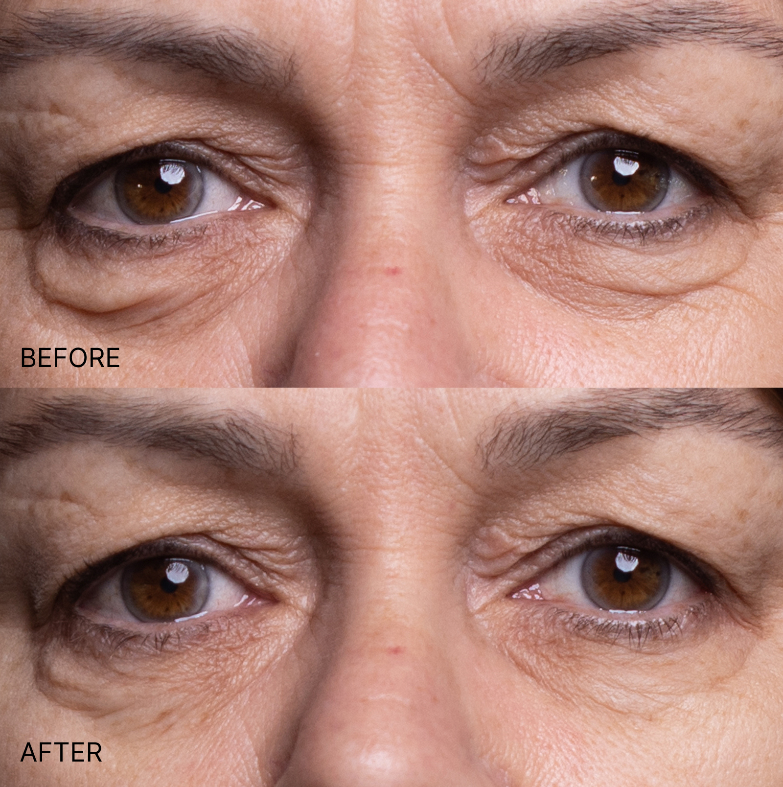 Ultimate Wrinkle Smoothing Set
