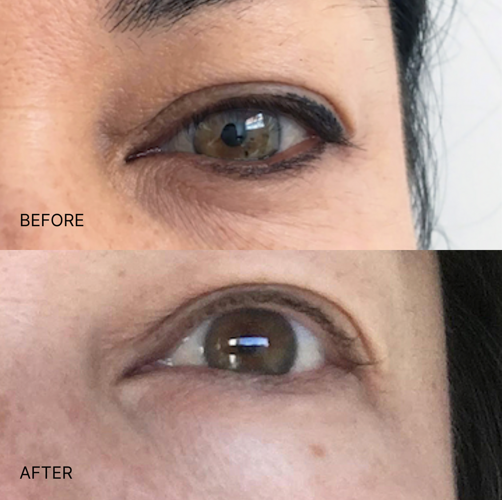 Ultimate Wrinkle Smoothing Set
