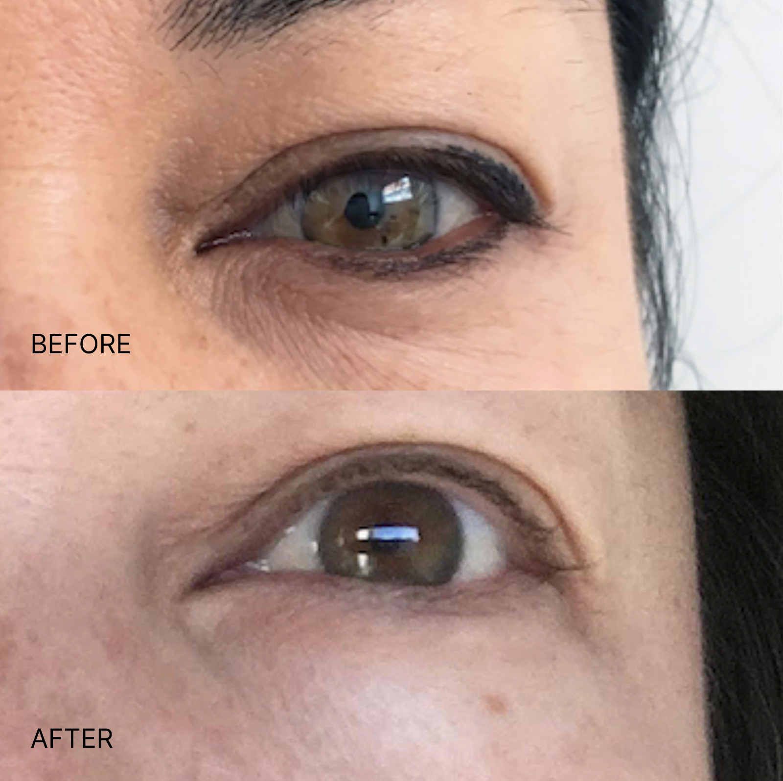 Ultimate Wrinkle Smoothing Set
