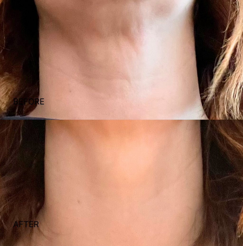 Wrinkle Smoothing Neck Patch