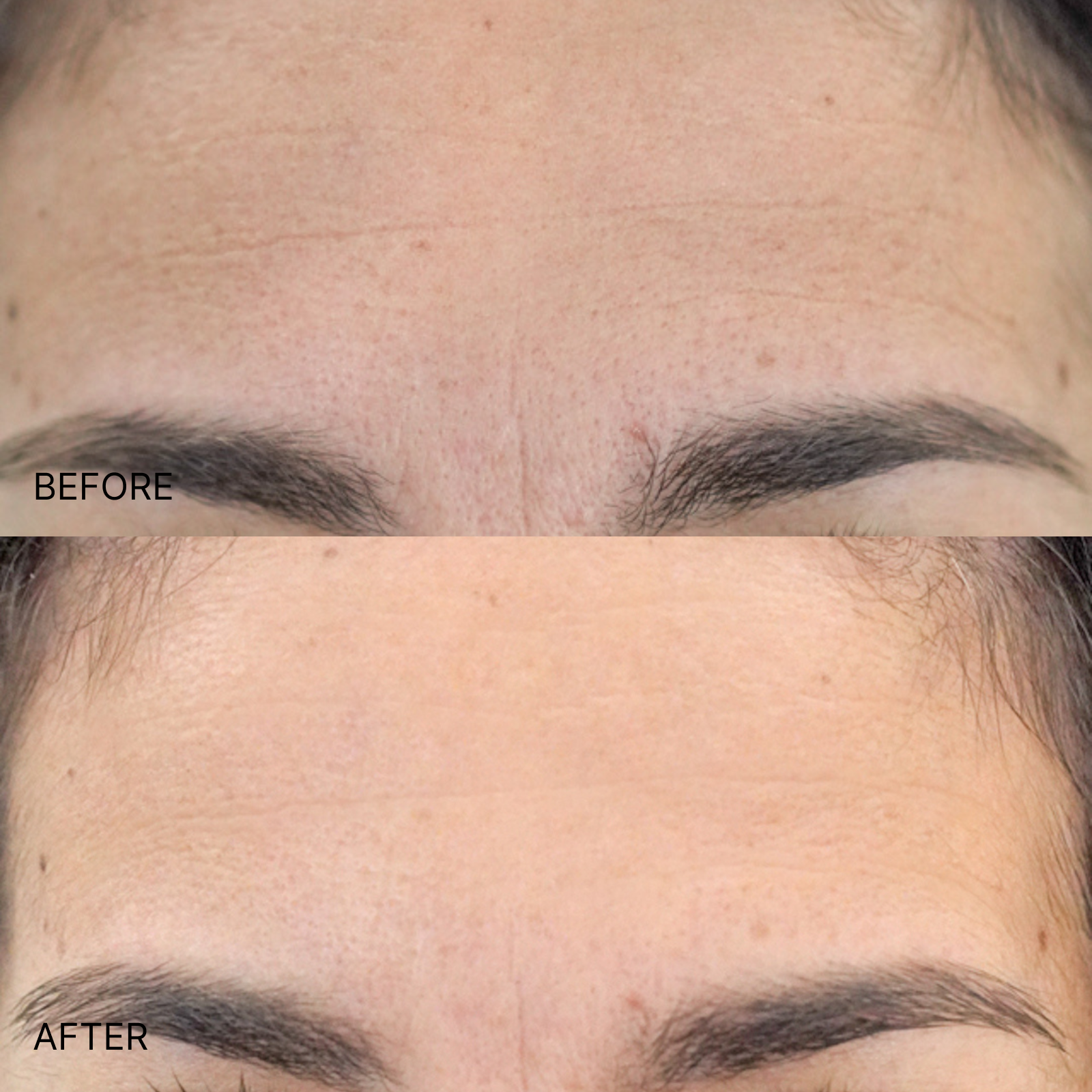 Ultimate Wrinkle Smoothing Set