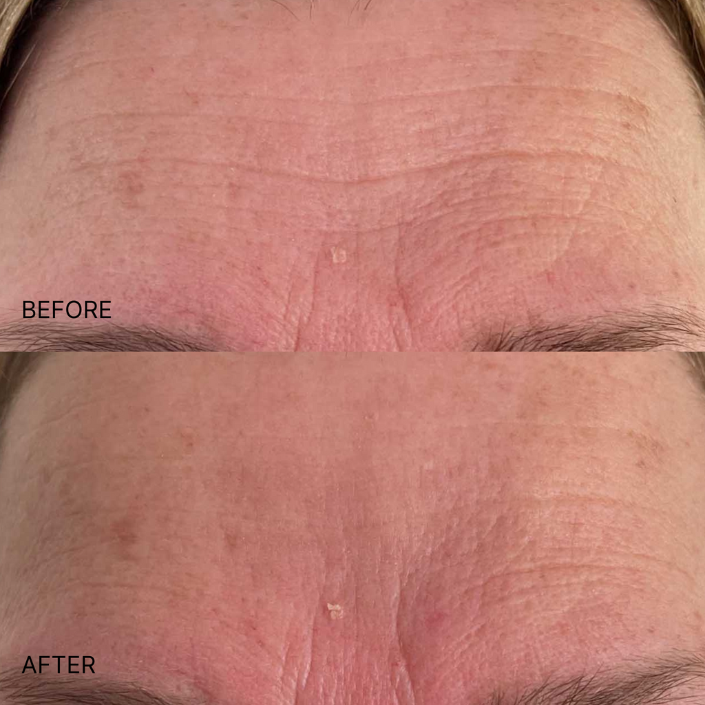 Ultimate Wrinkle Smoothing Set
