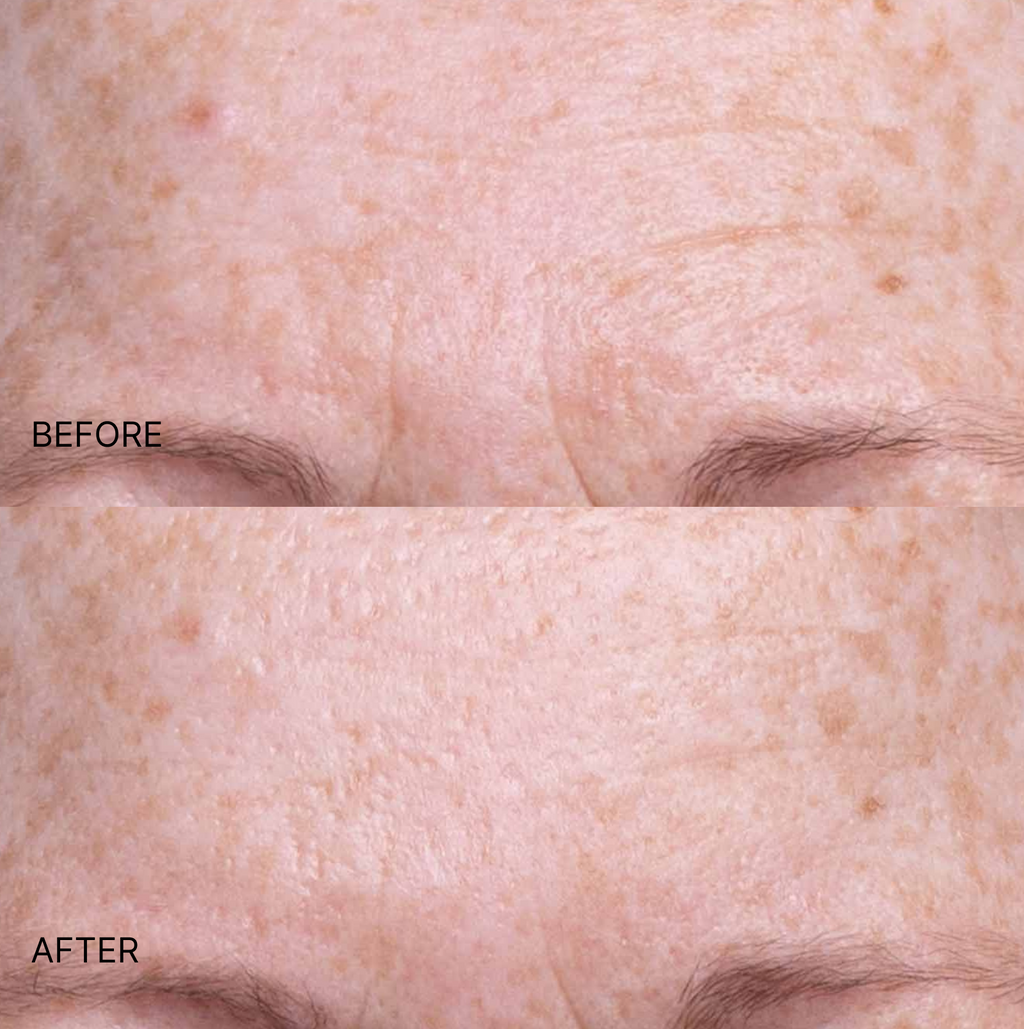 Ultimate Wrinkle Smoothing Set