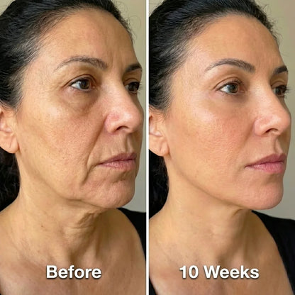 Collagen Face Sculpt Wrap