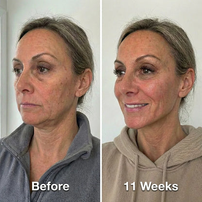 Collagen Face Sculpt Wrap